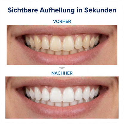LUMIVIO™ Toothpaste V34