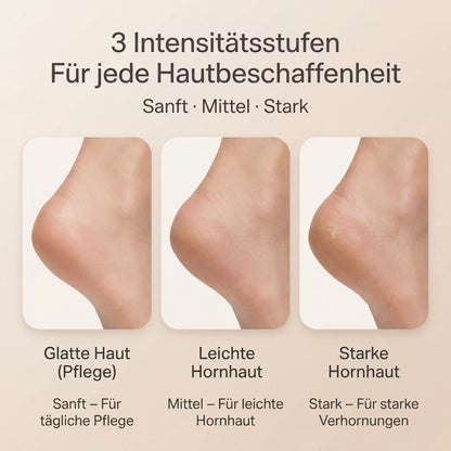 Electric callus remover