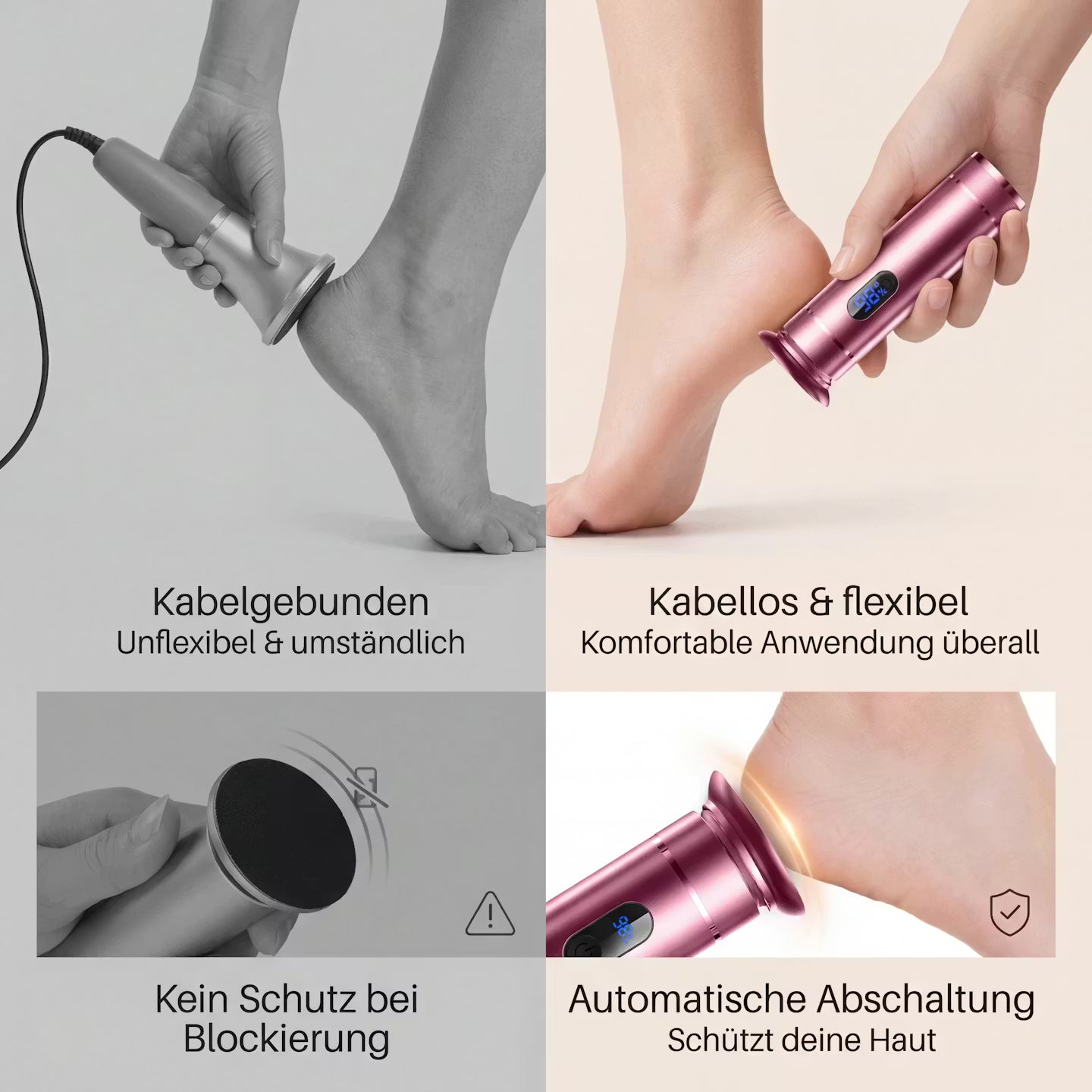 Electric callus remover