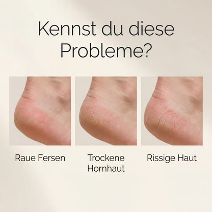 Electric callus remover